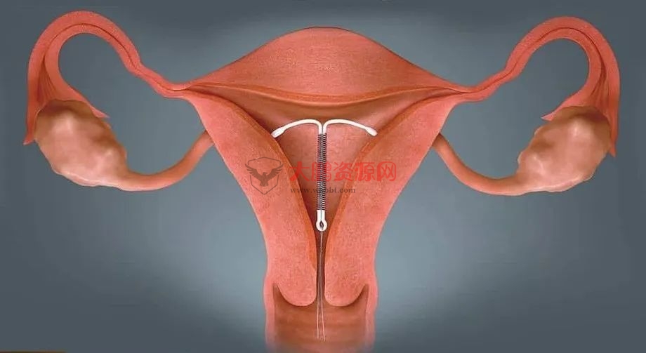 图片[4]-避孕不止安全套，17种避孕方法了解一下好兄弟们-酷库源码网